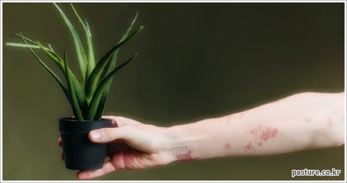 발진 원인 증상 예방 완벽 가이드 이렇게 확인하세요 발진 원인 증상 예방 완벽 가이드 이렇게 확인하세요