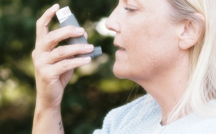 햇빛 알레르기 증상과 원인 및 효과적인 치료 연고 안내 햇빛 알레르기 증상과 원인 및 효과적인 치료 연고 안내